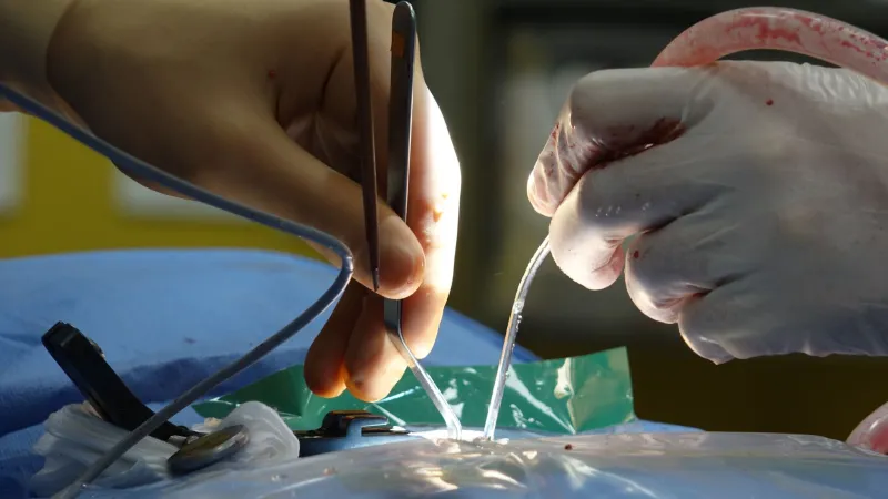 He Talked His Colleagues Through Removing His Own Brain Tumor — From the Operating Table